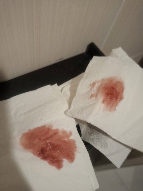 ท้อง6สัปดาห์มีเลือดออก