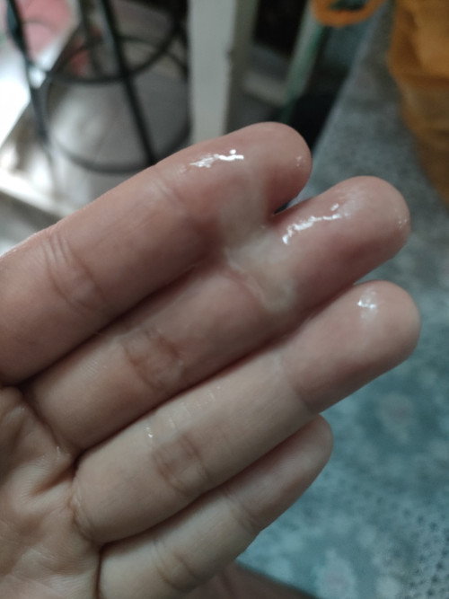 Hamil di 9 Minggu 1 hari,anak ke 2