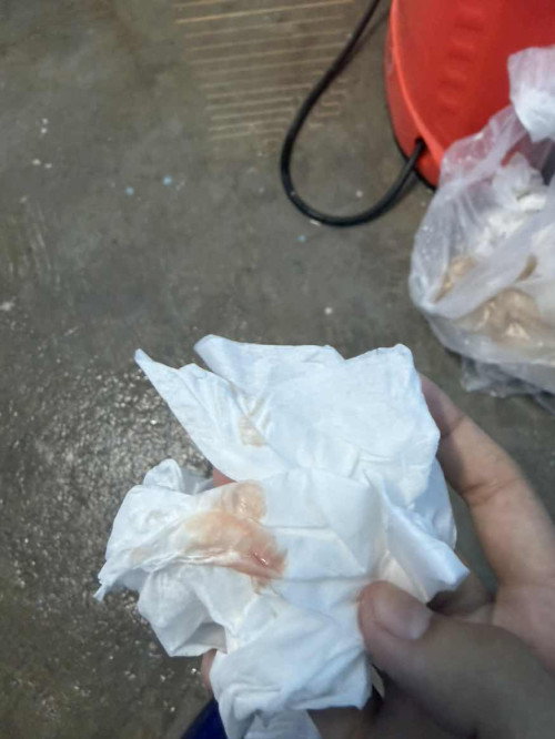 อยากถามค่ะแม่ๆบ้านไหนเป็นแบบนี้บ้าง