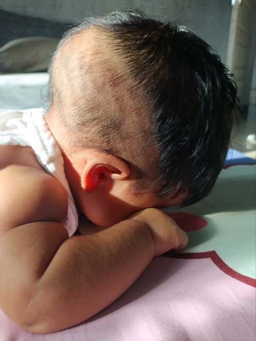 Kepala lonjong kebelakang