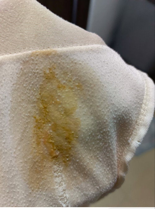 Flek atau keputihan ya?