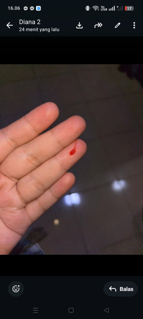 Flek waktu kehamilan