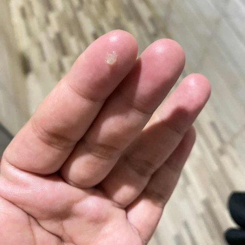 35+4 ปกติมั้ยคะหรือเริ่มเตือนๆเเล้ว เเอบกังวลท้องเเรก🥹🥹