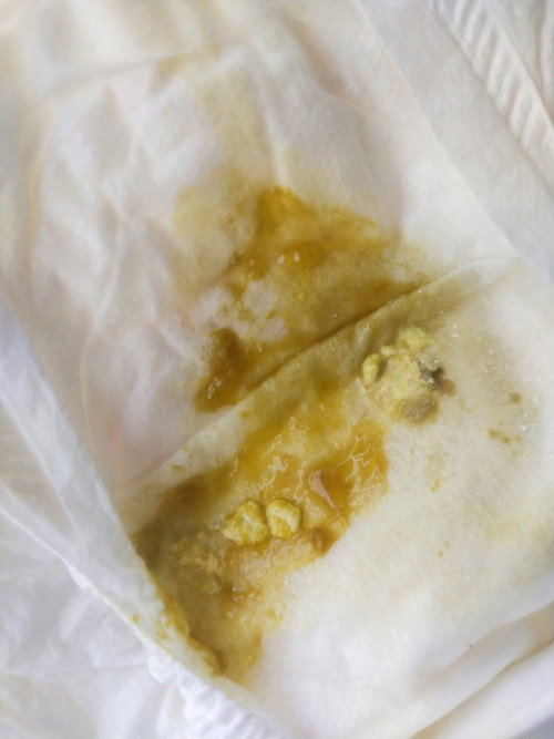 ลูกถ่ายเป็นมูก