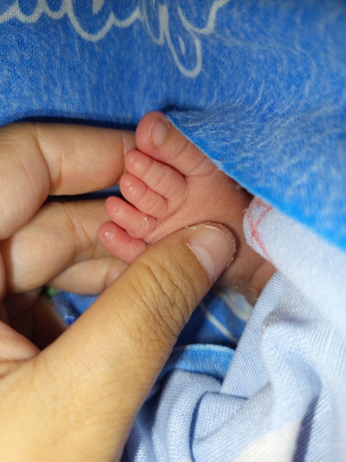 kuku bayi saya pas lahir gk ada.an apakah nanti bklan tumbuh sendiri  gk iya ? 🥹