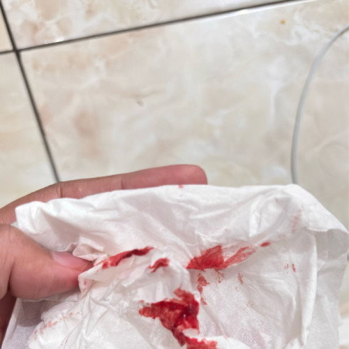 Ada yg pernah ngrasain gak