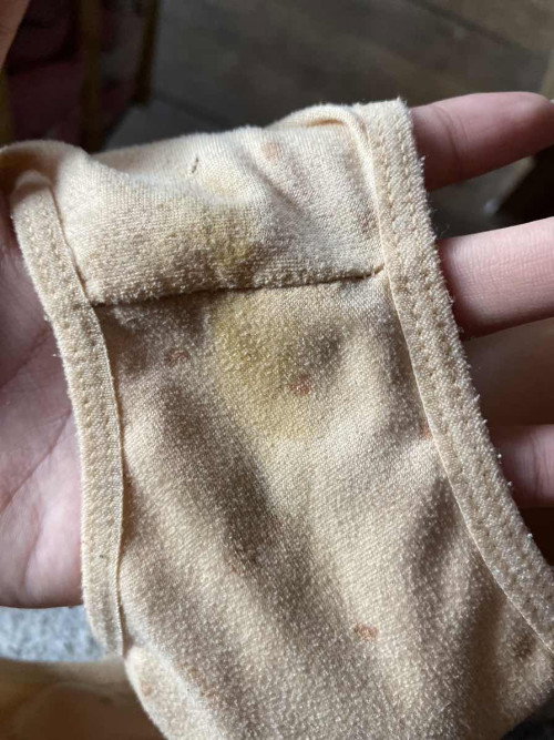 เจอคราบที่กางเกง ท้องสอง