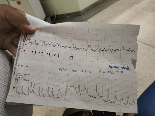 กราฟแบบนี้ท้องแข็งไหมคะ