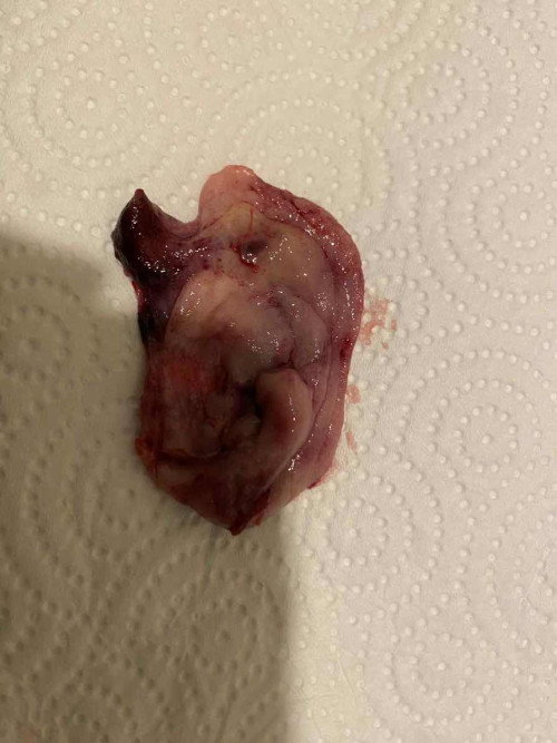 แบบนี้ใช้แท้งมั้ยค่ะแม่ๆ