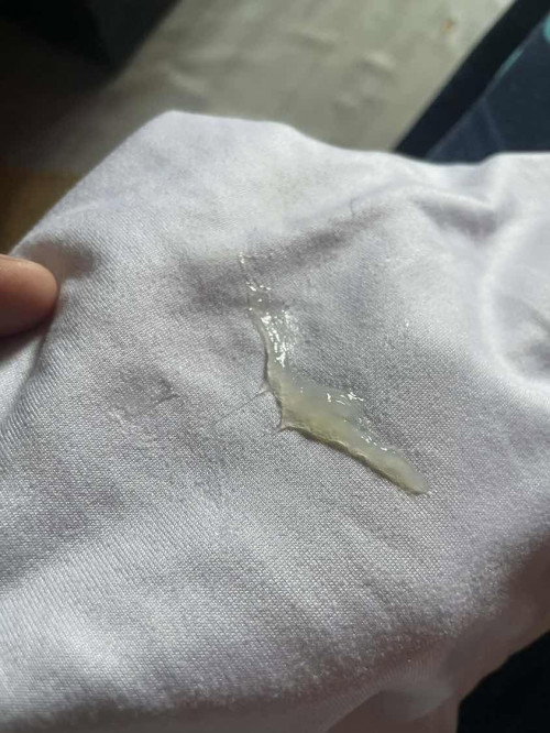 NORMAL LANG PO BA UNG GANTO NA DISCHARGE SA 24 weeks buntis?