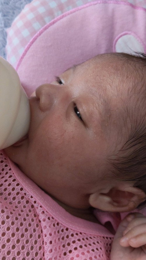 ผื่นที่หน้า