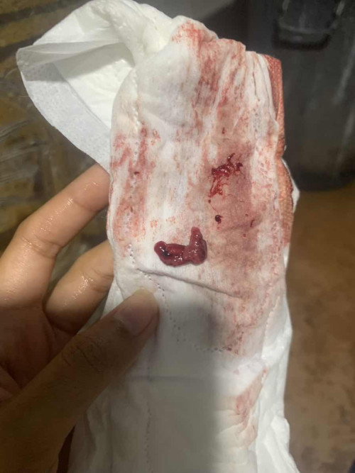 ขอคำปรึกษาหน่อยค่ะ