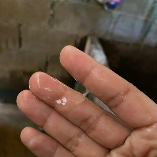 อันนี้มูกใสหรือตกขาวคะแม่ๆ ตอนนี้39+1