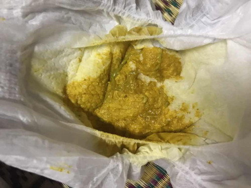 อึแบบนี้ปกติมั้ย