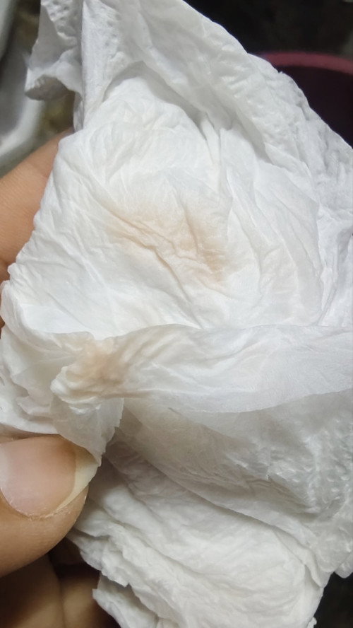 ใช่เลือดล้างหน้าเด็กหรือเปล่า