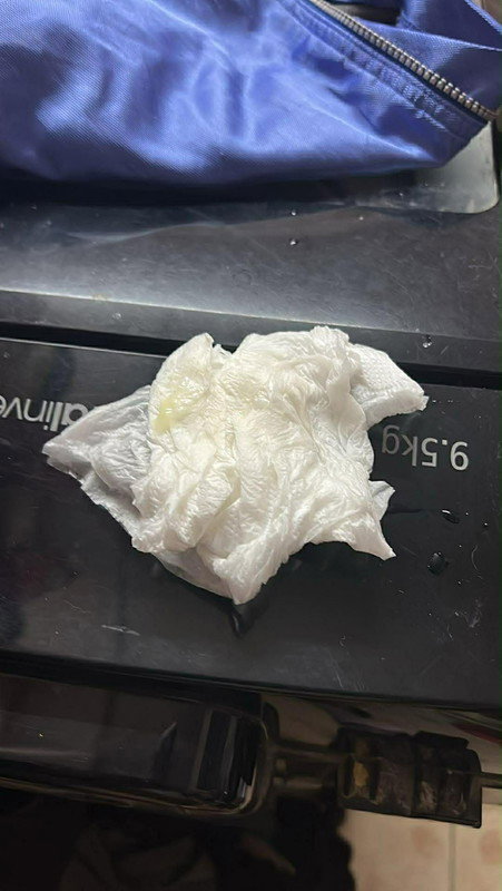 แบบนี้เรียกตกขาวหรือมูกค่ะแม่ๆ 38+1