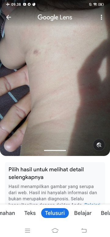 Bintik2 merah ada airnya