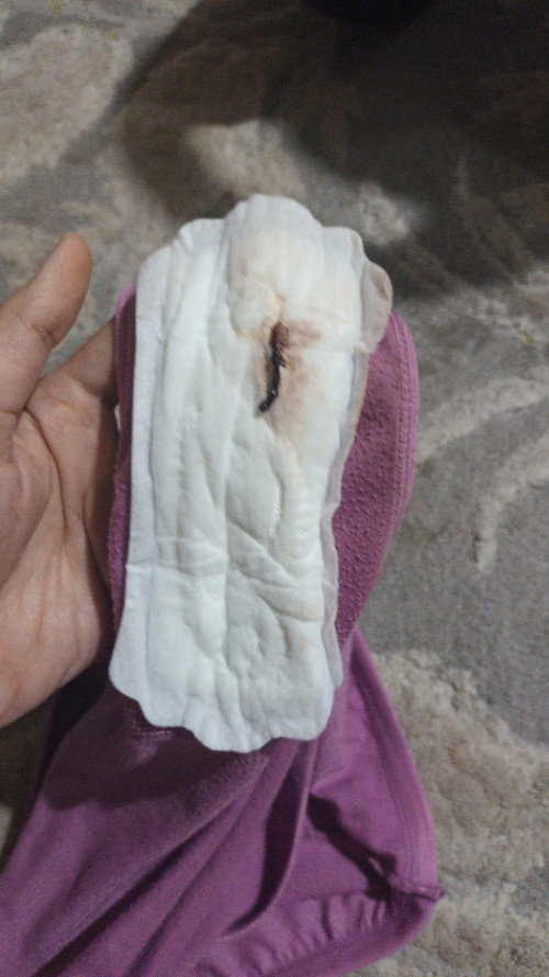 Apakah ini darah implantasi?