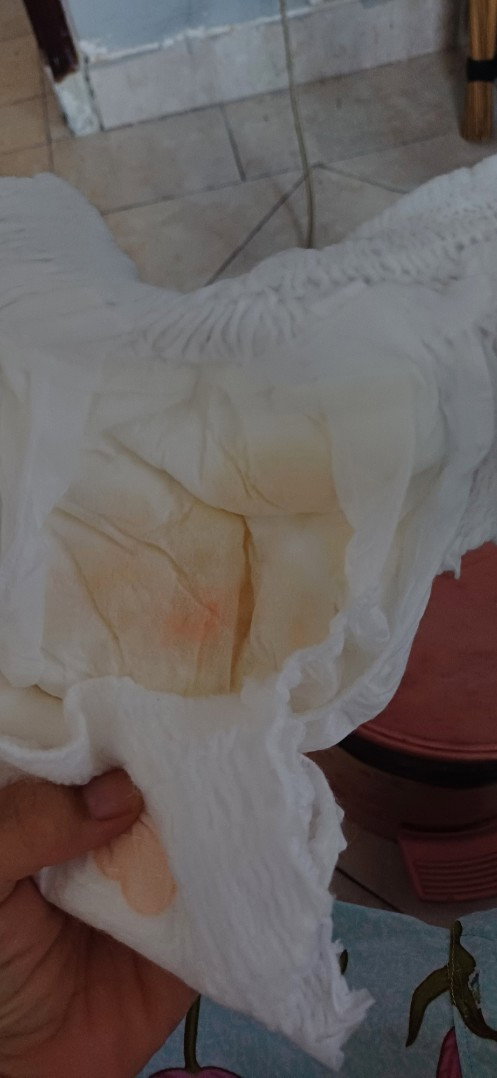 Kencing seperti ada darah