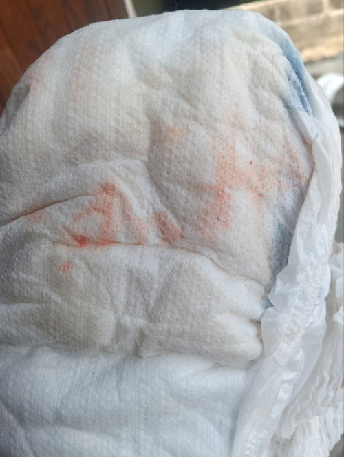 ขอถามแม่ๆจ้า