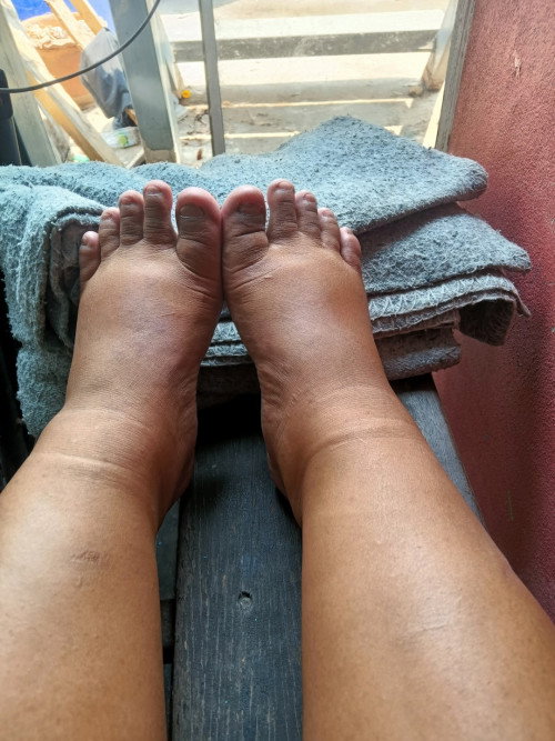 ท้องได้ 35 วีคกับ 1 วัน