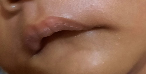 Bibir bawah menjorok ke dalam