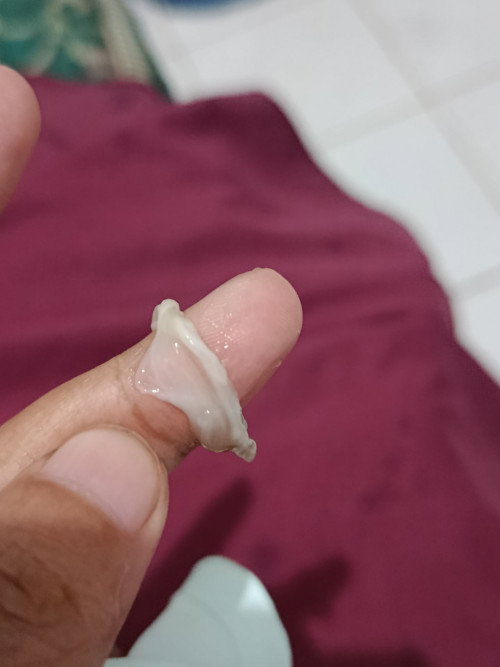 Muncul gumpalan putih sedikit coklat