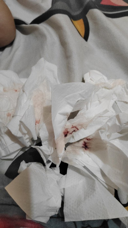 Usia 38 weeks, keluar lendir darah