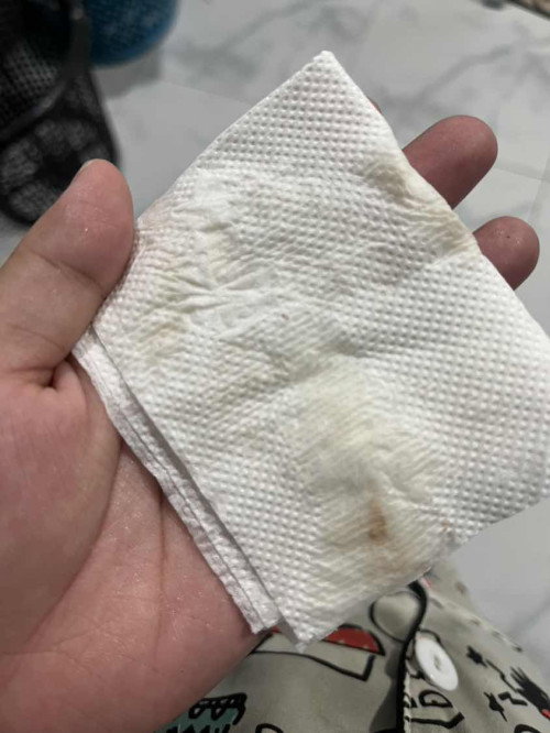 แบบนี้ใช่มูกปนเลือดไหมคะ