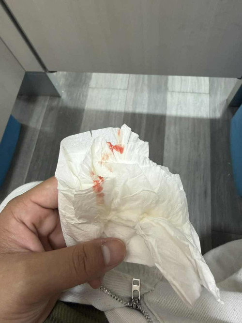 ขอสอบถามแม่ๆหน่อยงับ🥹🙏🏻