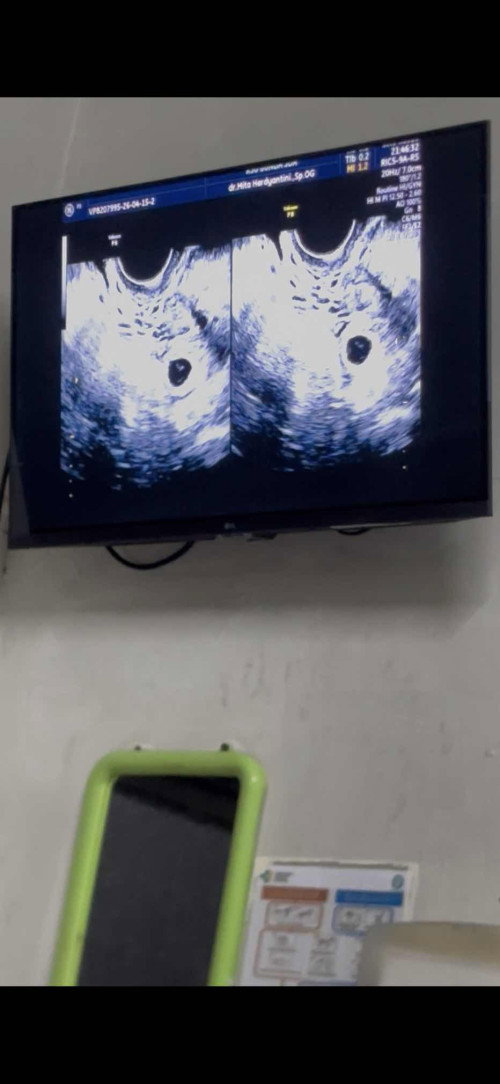 Ada yang tau gak ya