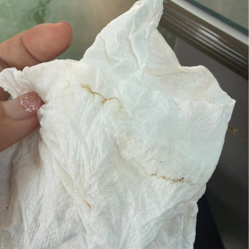 ภาวะแท้งคุกคาม 12 สัปดาห์ 3 วัน
เมื่อวานพบตกขาวปนเลือดสีน้ำตาล เวลา** censored privacy number **น.