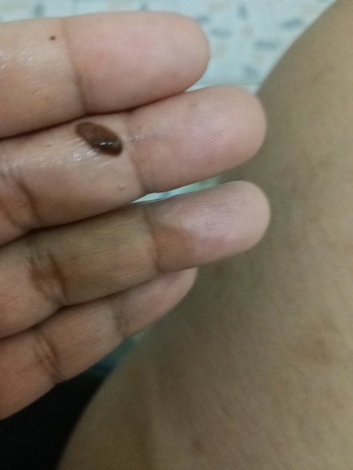 สอบถามแม่ๆหน่อยค่ะ