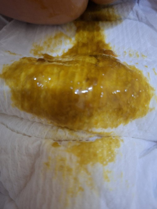 Diare atau bukan ya?