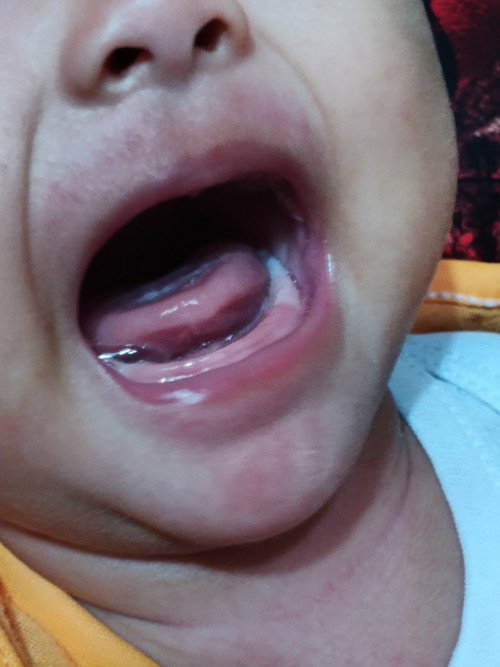 Gusi bagian dalam kok warnanya putih kenapa ya bund?