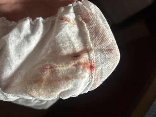 Bleeding 12 Weeks