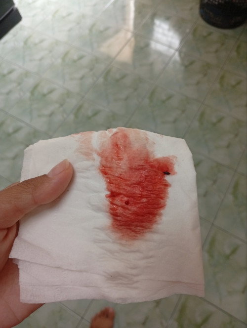 ภาวะแท้งคุกคาม
สอบถามแม่ๆที่มีประสบการณ์แท้งคุกคามหน่อยค่ะ