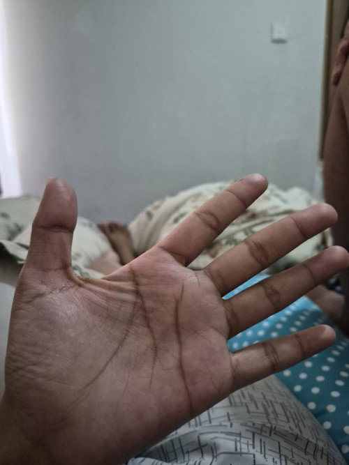 Bumil masuk awal tm 2, tangannya kek tebel gt ga sih pas di kepal 🥲 aplg pas bngn tidur kek sakit.
