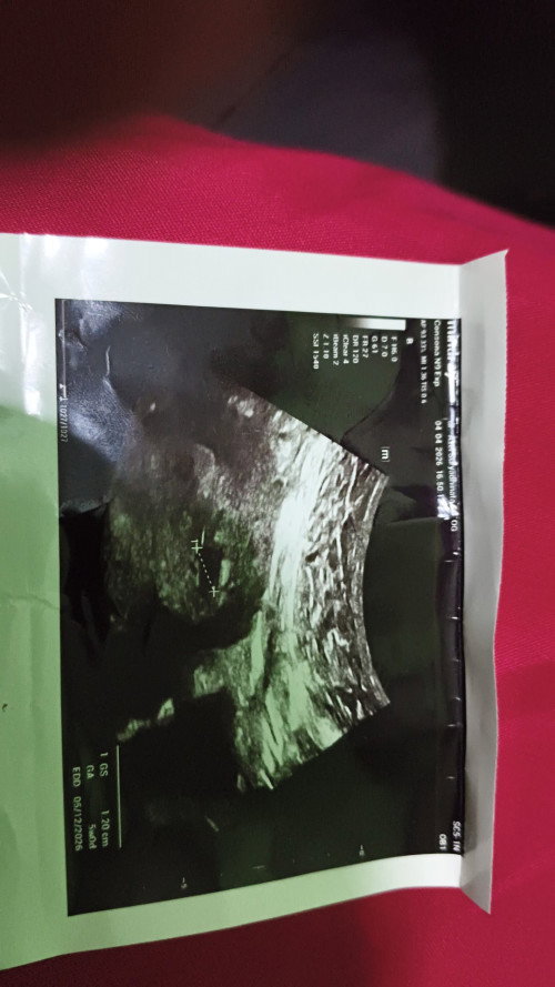 Hamil 7 week