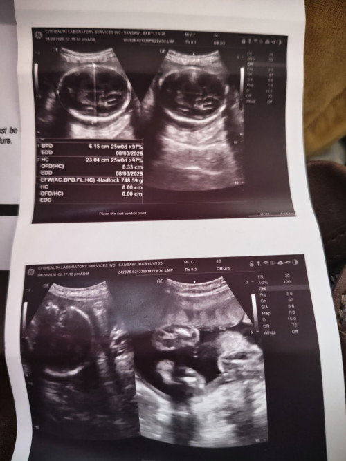 Hello po may marunong po ba dito tumingin ng pelvic ultrasound