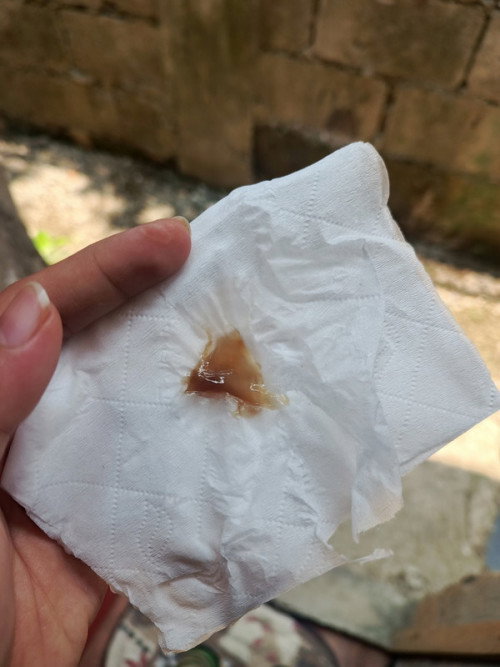 Mucus plug na po ba to? Yung texture niya po kasi is parang jelly after ko ma IE niyan kinabukasan