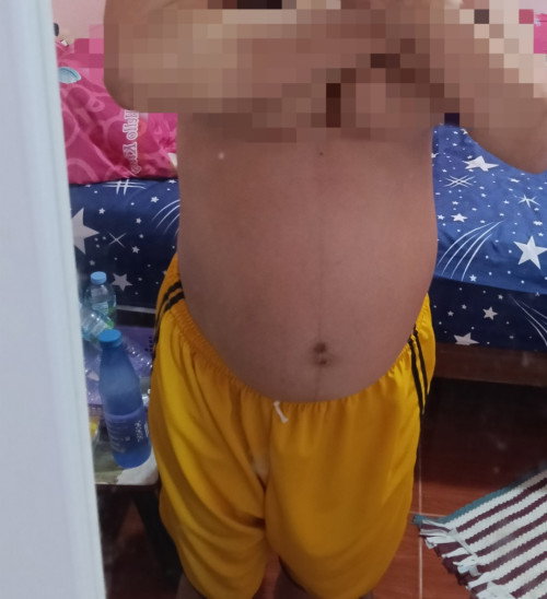 8เดือนมีใครท้องลดแล้วบ้างคะ