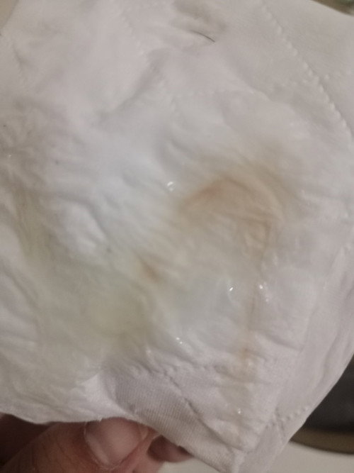 แบบนี้ใช่มูกใสไหมค่ะ