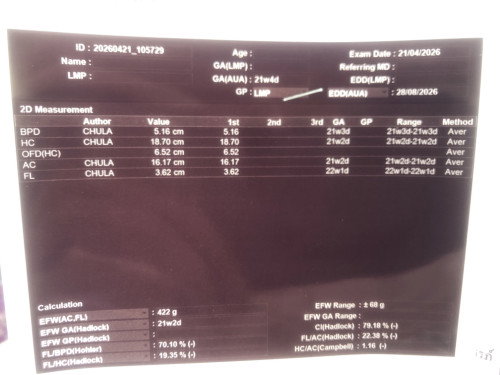 21สัปดาห์2วันค่ะแม่ๆ