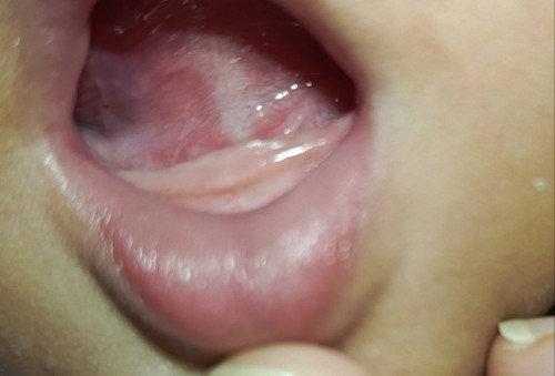 Ciri gusi tumgi bukan?