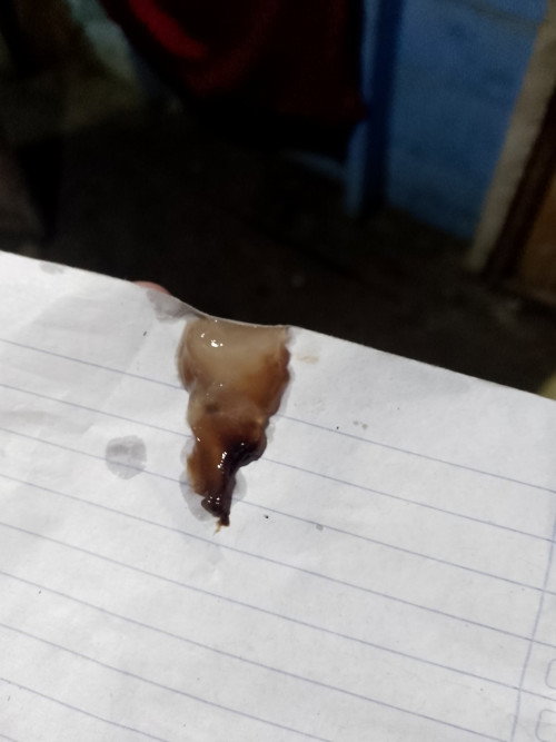 Tanda lendir dan darah coklat apakah sudah dekat melahirkan ?