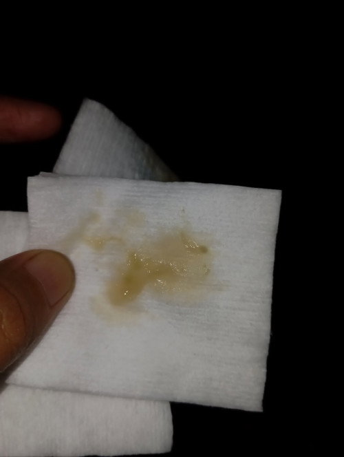 Keputihan kuning kecoklatan