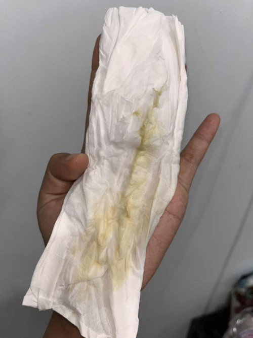 keputihan kuning