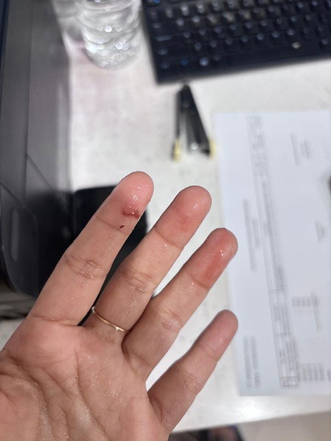 Flek 2 hari berturut2