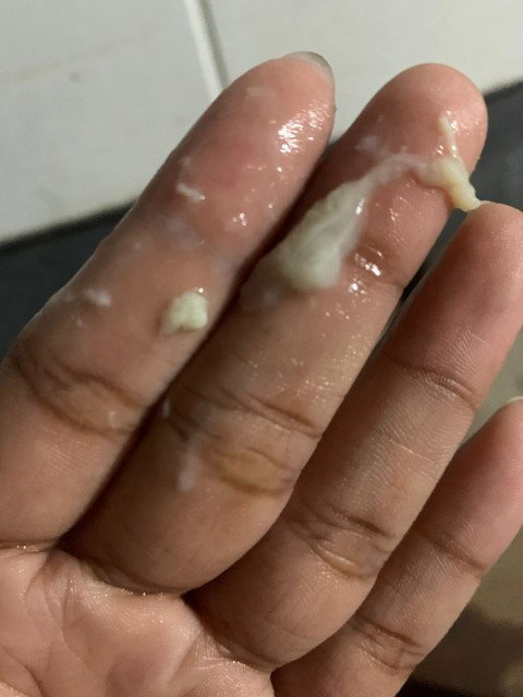 sorry klw mejijikkan nak Tanya normal ke keputihan begini seawal 6 minggu tapi tiada bau apa" pun